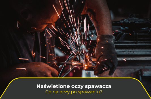 Naświetlone oczy spawacza. Co na oczy po spawaniu?