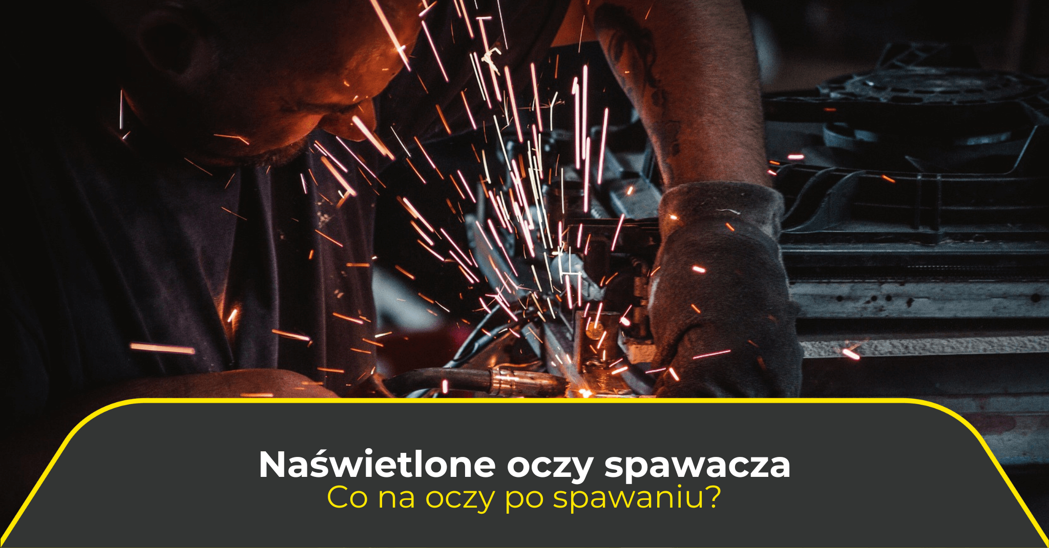 Naświetlone oczy spawacza. Co na oczy po spawaniu?